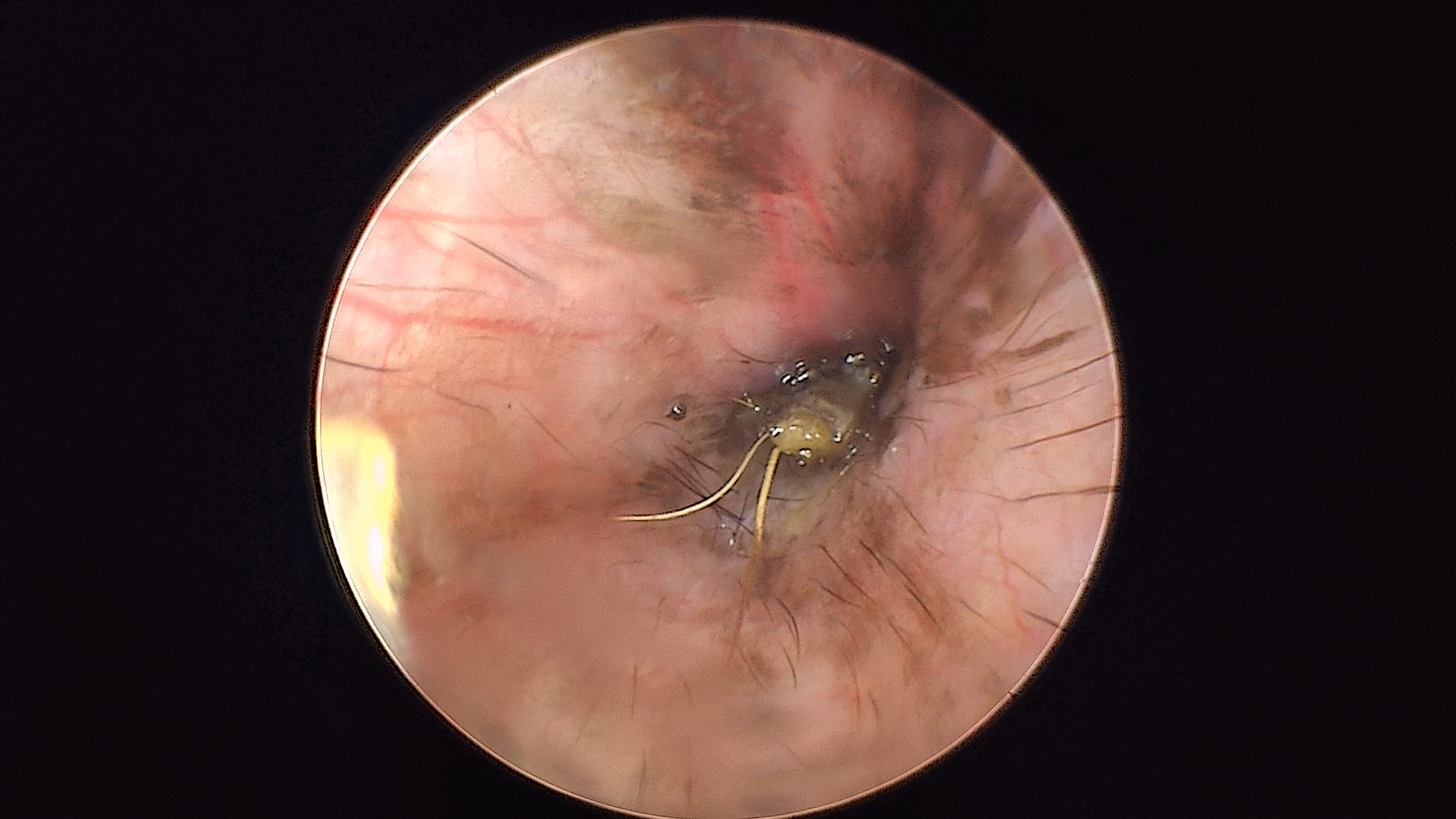 bouchon proximal chez un bouledogue français